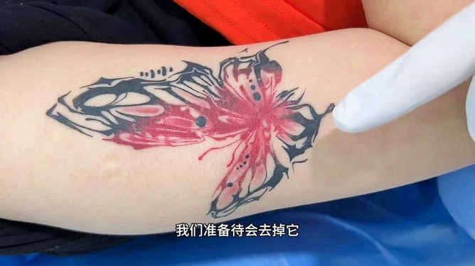 最新洗纹身,最新洗纹身技术，解锁纹身去除新篇章，最新洗纹身技术揭秘，解锁纹身去除新篇章